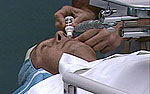 Your eye will be completely numbed before the procedure.