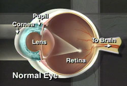 A slit lamp can detect corneal disease at an early stage